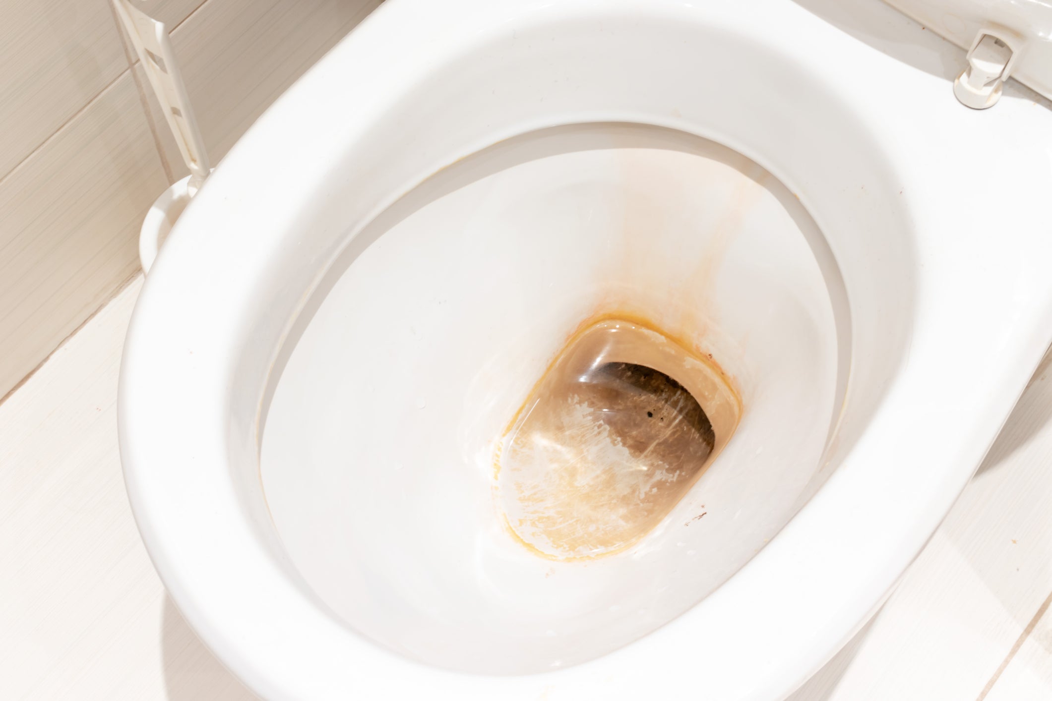 What causes toilet stains
