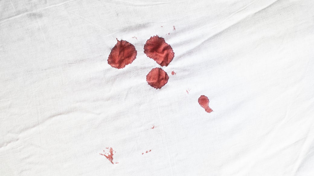 How to Get Blood Stains Out of Sheets With Bleach