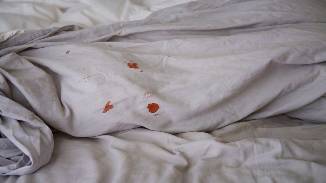 exótico inoxidable Cumplir Cómo quitar manchas de sangre de la ropa usando blanqueador | Clorox®