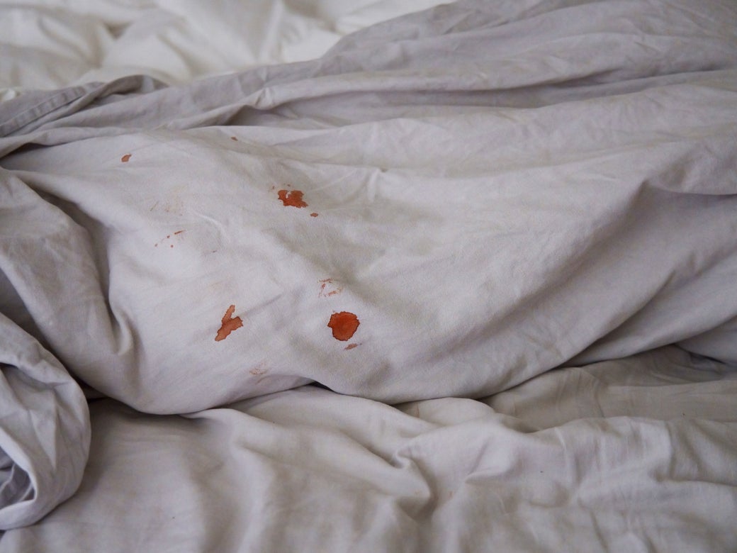 piel Marcha atrás blanco lechoso Cómo quitar manchas de sangre de la ropa usando blanqueador | Clorox®