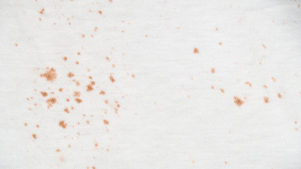 quitar manchas anaranjadas de óxido de ropa | Clorox®